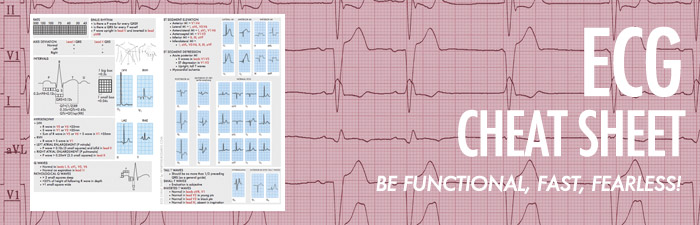 ecg-interpretation-made-easy-pdf-amulette