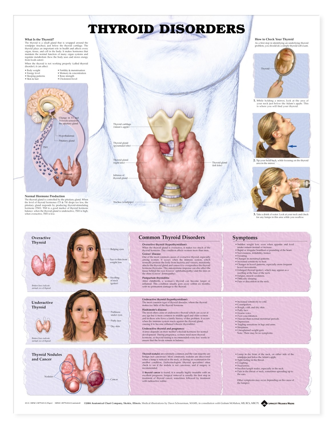 Thyroid Disorders Anatomical Chart Anatomy Models and Anatomical 